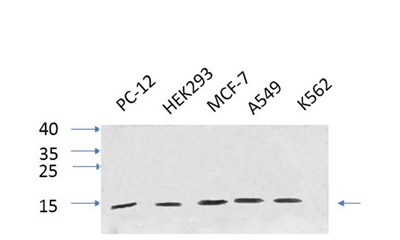 Human IL-8 Polyclonal Antibody