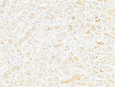 CD26 Polyclonal Antibody