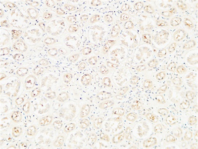 CD26 Polyclonal Antibody