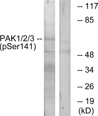PAKα/β/γ (phospho Ser144/141/139) Polyclonal Antibody