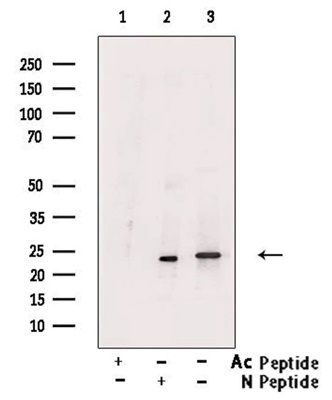 Acetyl-SOD2/MnSOD (Lys122) Antibody