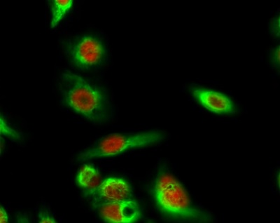 SIRT1 Polyclonal Antibody