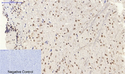 SIRT1 Polyclonal Antibody