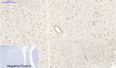 SIRT1 Polyclonal Antibody