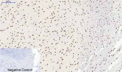 SIRT1 Polyclonal Antibody