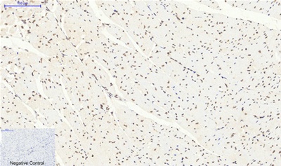 SIRT1 Polyclonal Antibody