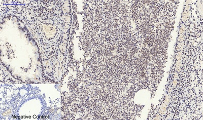 SIRT1 Polyclonal Antibody