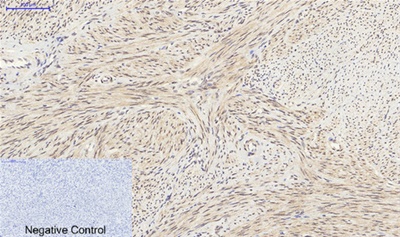 SIRT1 Polyclonal Antibody