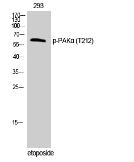 Phospho-PAK1 (Thr212) Polyclonal Antibody