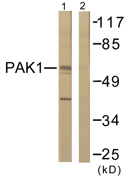PAK1 Polyclonal Antibody