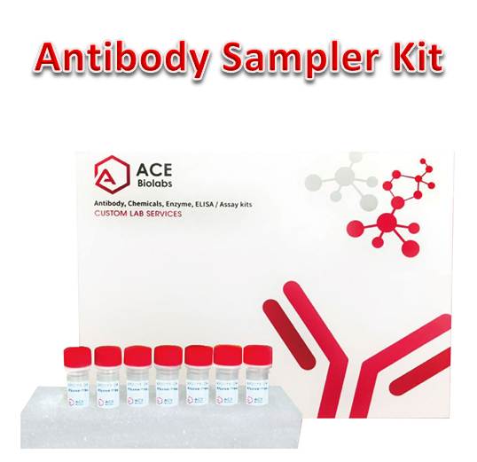 Lysine Acetyltransferase Antibody Sampler Kit
