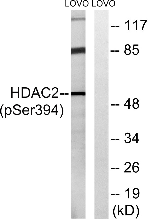 Phospho-HDAC2 (Ser394) Polyclonal Antibody