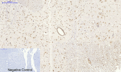 SIRT1 Polyclonal Antibody