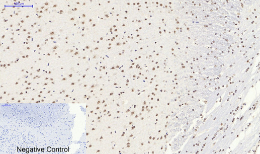 SIRT1 Polyclonal Antibody