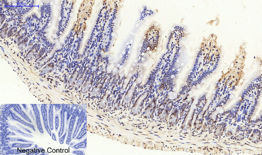 SIRT1 Polyclonal Antibody