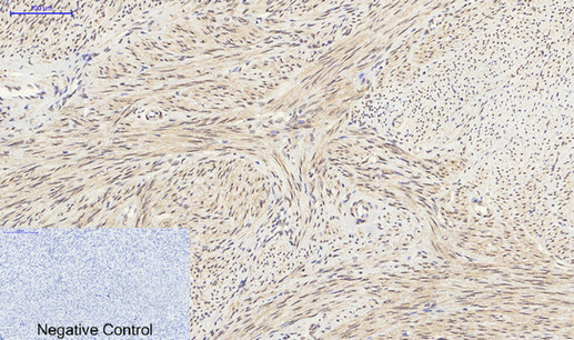 SIRT1 Polyclonal Antibody